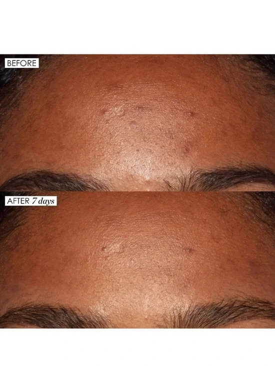 Sunday Riley Sample/Mini Pack Bundle - Picture 5 of 5